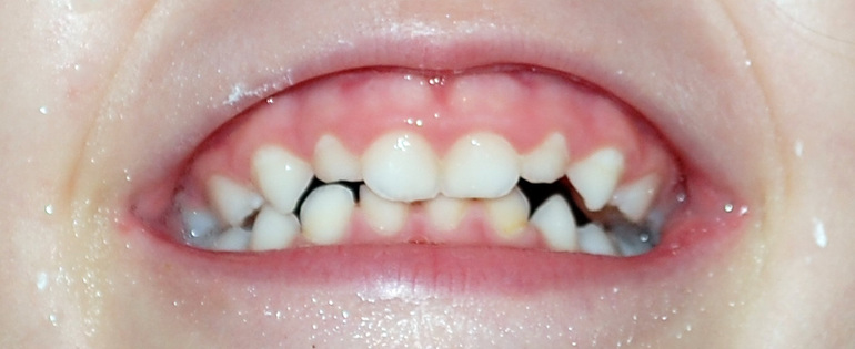 Поможет ли Айкон?