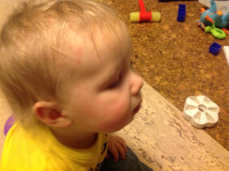 Ротовирус и пятна