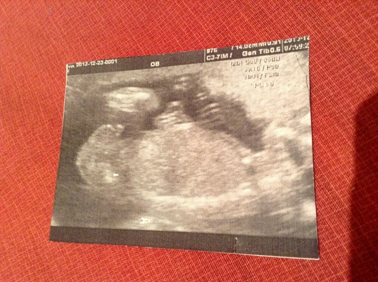 Точно мальчик?:)