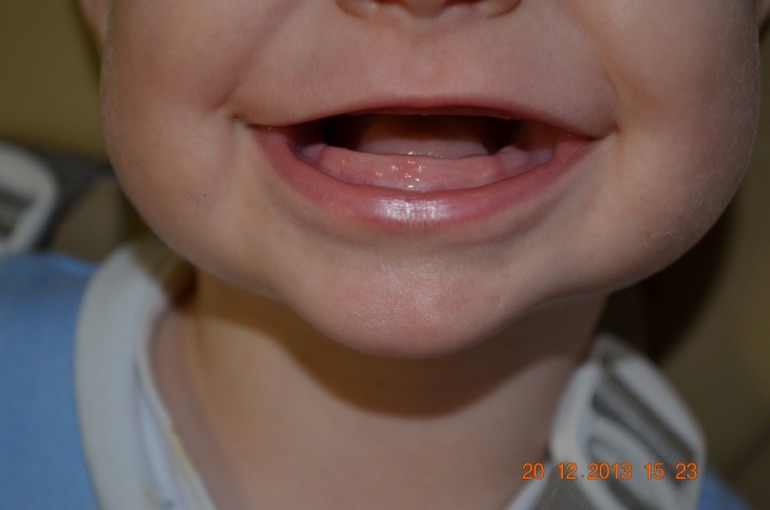 Зубы это или нет?