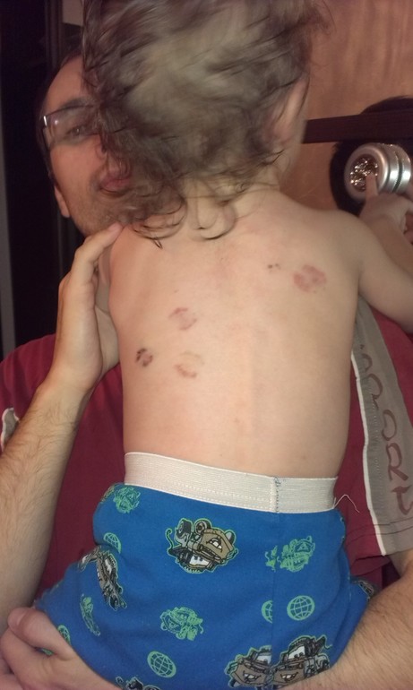 Вроде перестали кусаться!