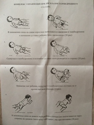 Дисплазия тазобедренного сустава