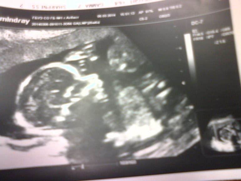второй скрининг...