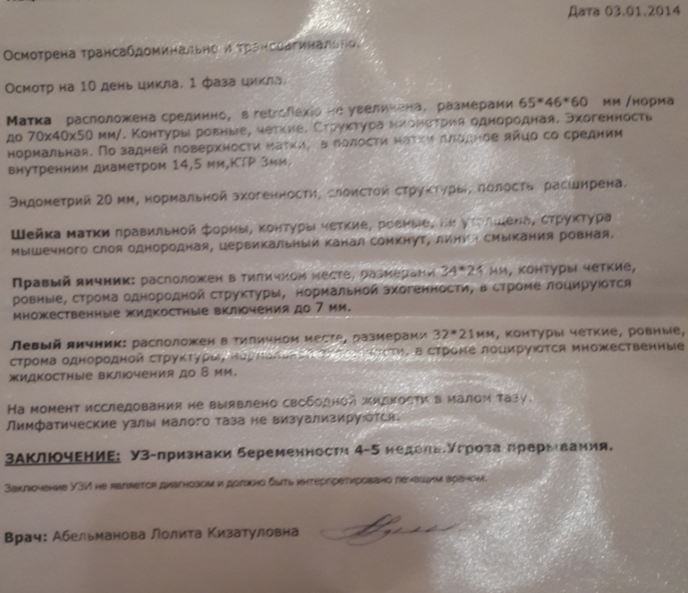 Узи.