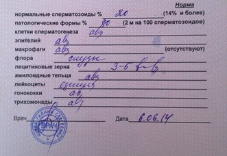 посмотрите кто понимает Спермограмму