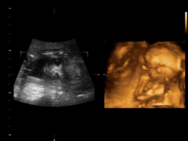 Ура! У нас в домике МАЛЬЧИК!