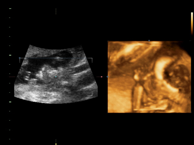 Ура! У нас в домике МАЛЬЧИК!