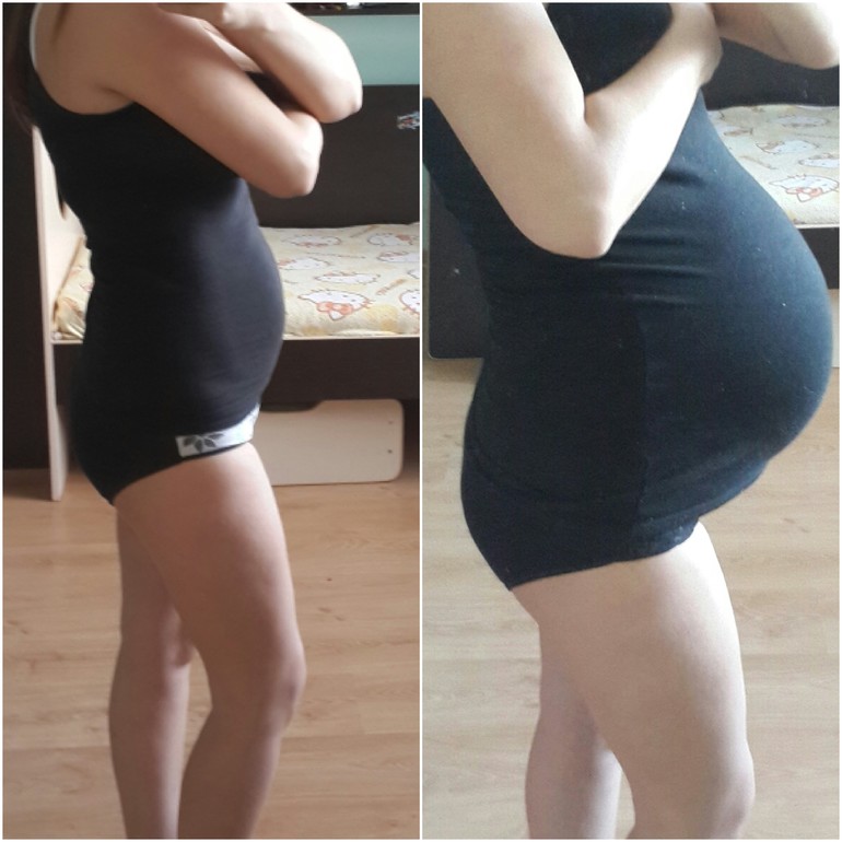 5 дней после родов