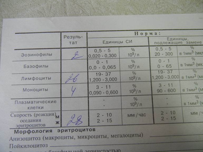 температура 5ый день... обструктивный бронхит