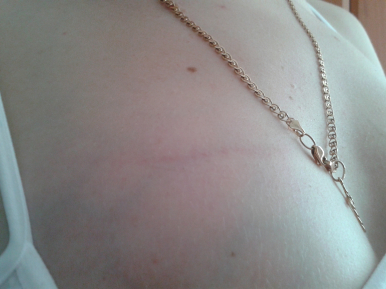 Неужели растяжка?