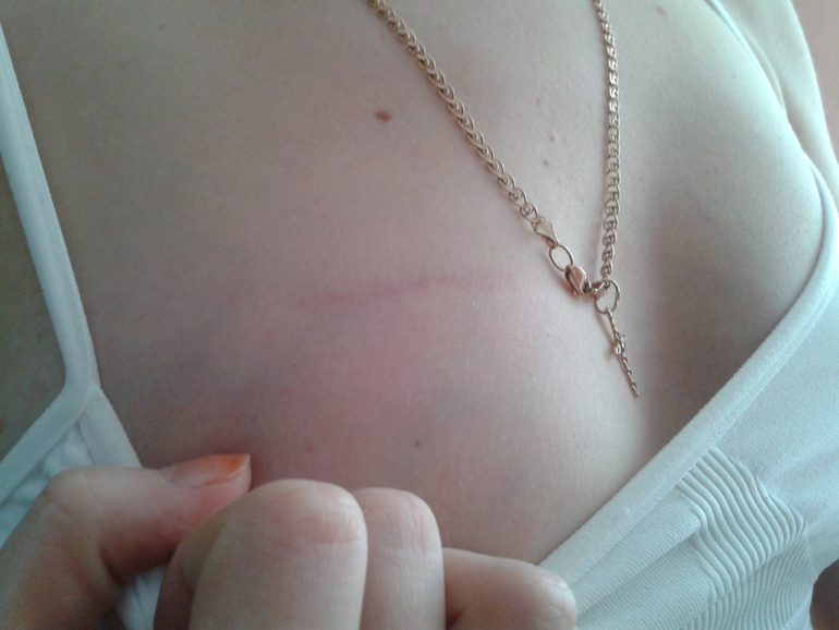 Неужели растяжка?