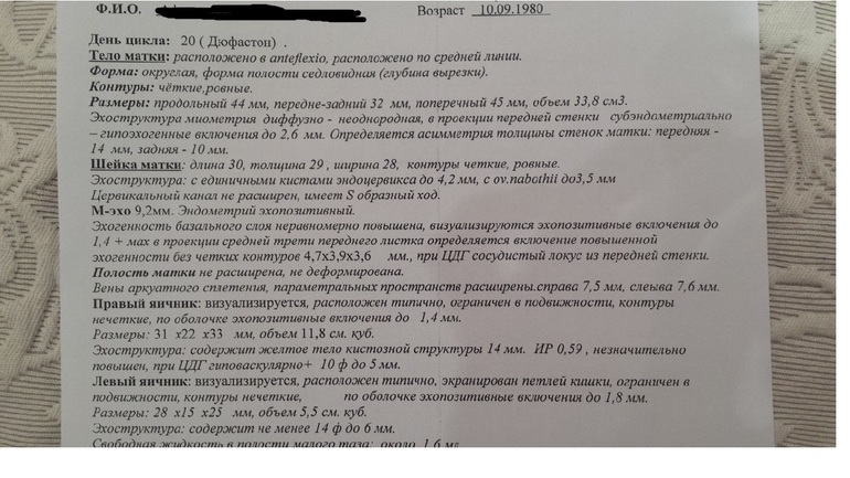 Доплер