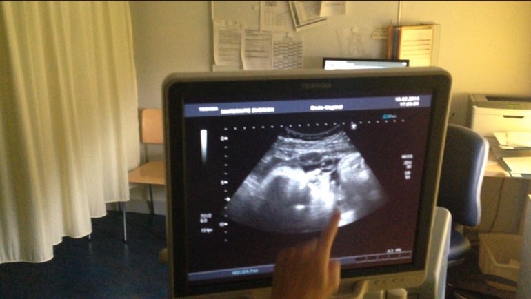 наши портретные Узи в конце 38-ой недели