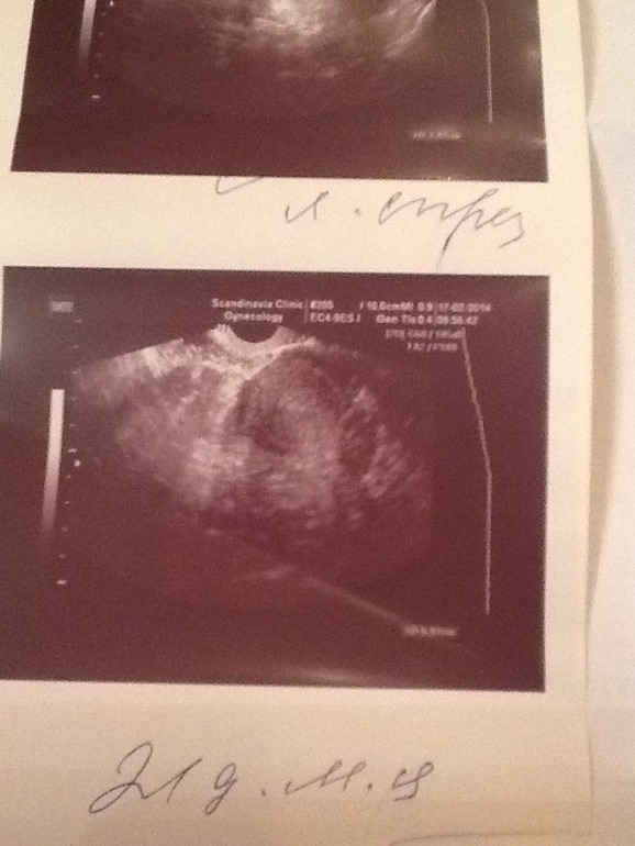 Слово гинеколога не обсуждается??или??