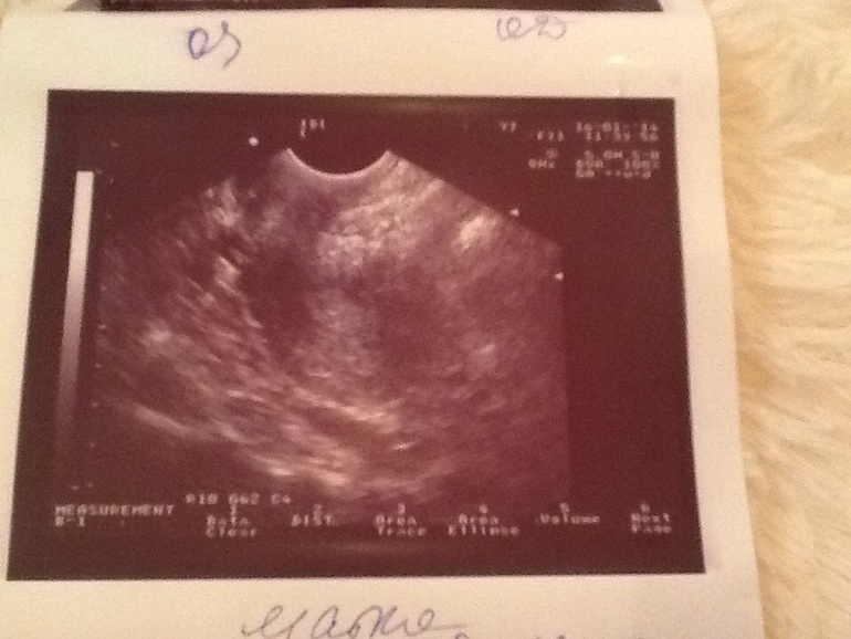 А где здесь матка???кто разбирается в узи,помогите!!!