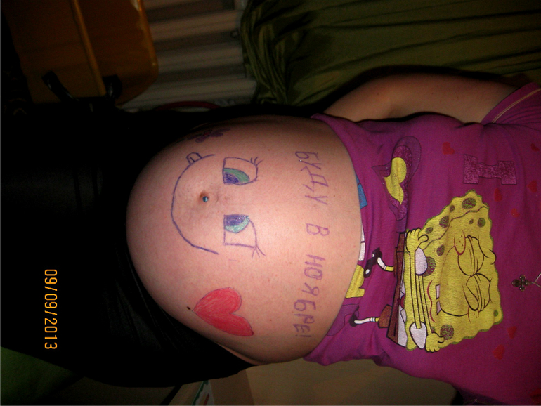 В ДОЛГОЖДАННОМ ОЖИДАНИИ ПЛЮС 25