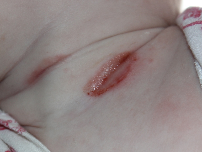 Помогите советом