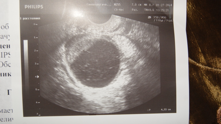 ну скажите хоть что нибудь...... не плакать,выть хочется.....