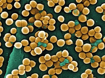 Главным резервуаром супермикробов оказалось человеческое жилье