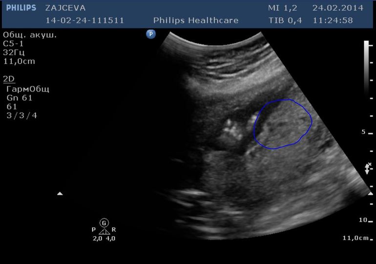 Наконец-то приветственный пост:)