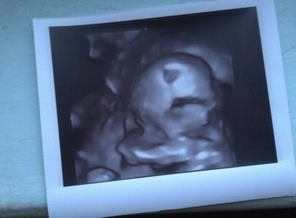 Девчушка!..))