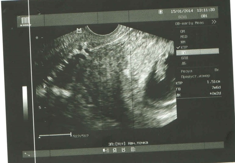 Взгляните на узи, пожалуйста!