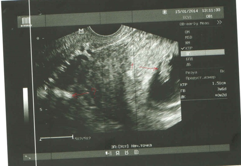 Взгляните на узи, пожалуйста!