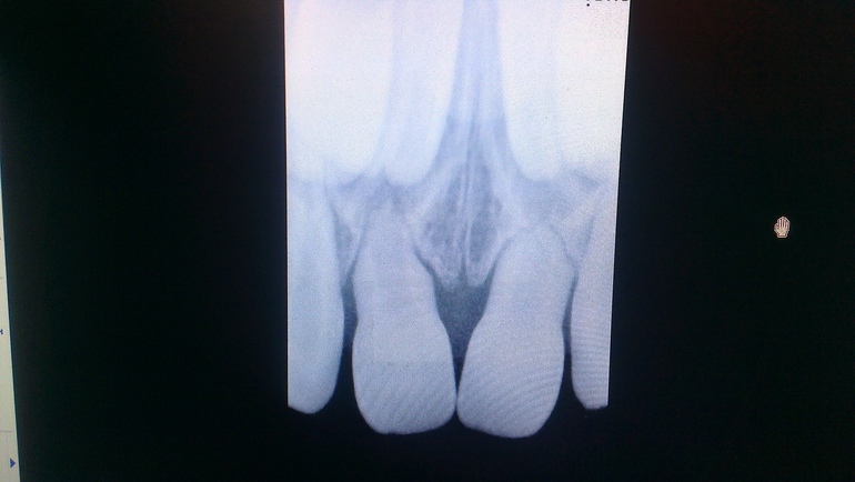 Есть снимок, подскажите