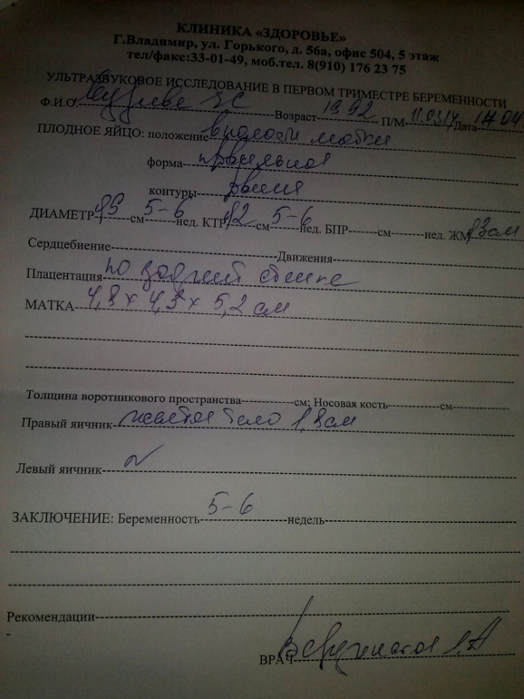 Мое УЗИ