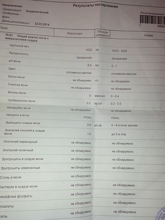 Анализ мочи!