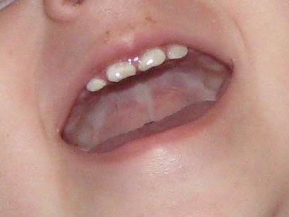 Что с зубами?