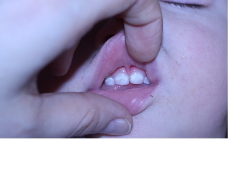 первые проблемы