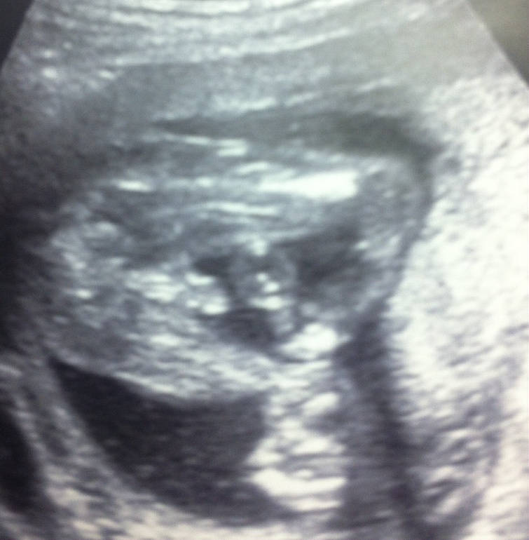 Подскажите пол малыша...!!!