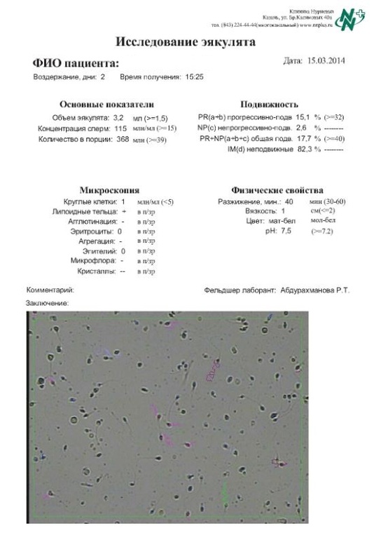 Пожалуйста помогите разобраться! Можно ли улучшить спермограмму?!