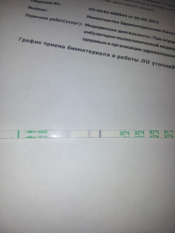 би-шур-с всегда врет?