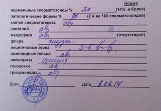 посмотрите кто понимает Спермограмму