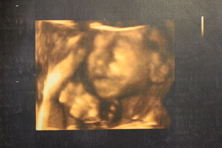 УРРРРАААААААААА!!!!!!!!!!!  УЗИ в 21 неделю)))))))