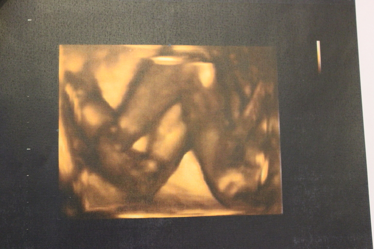 УРРРРАААААААААА!!!!!!!!!!! УЗИ в 21 неделю)))))))