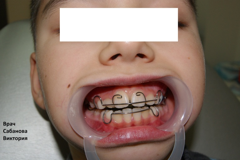 Как мы лечим на пластинках!