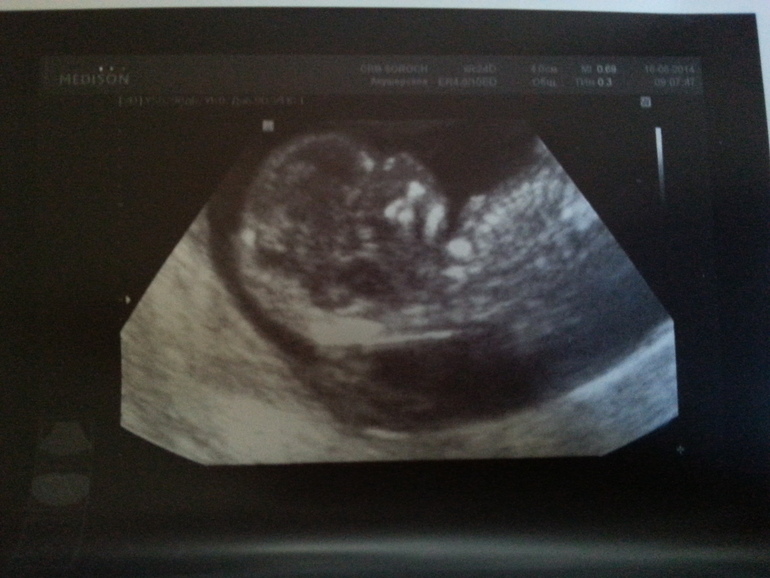 А вот и МЫ!!!