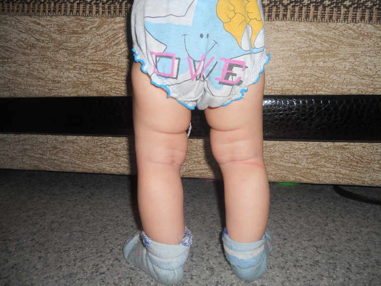 Ножки малышки