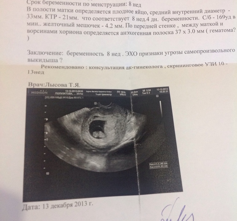 Тревожно