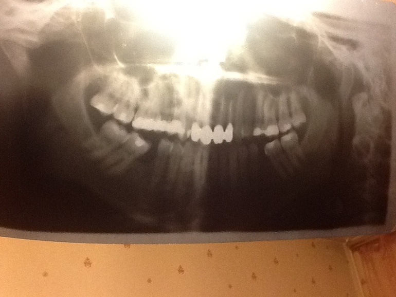 Доброй ночи,это снова я