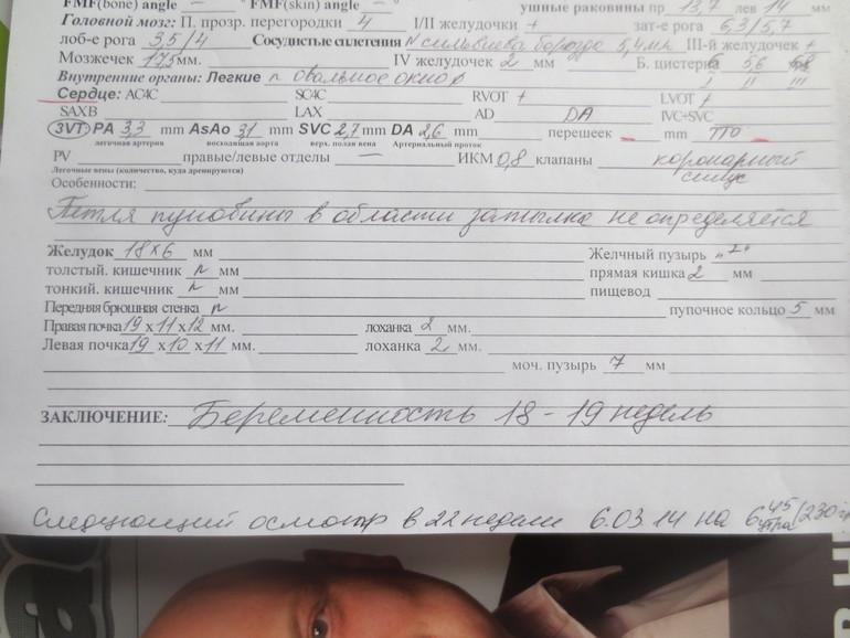 Незаконченное УЗИ...