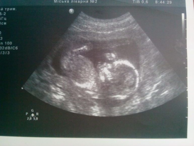 Угадайте, кто там?:)