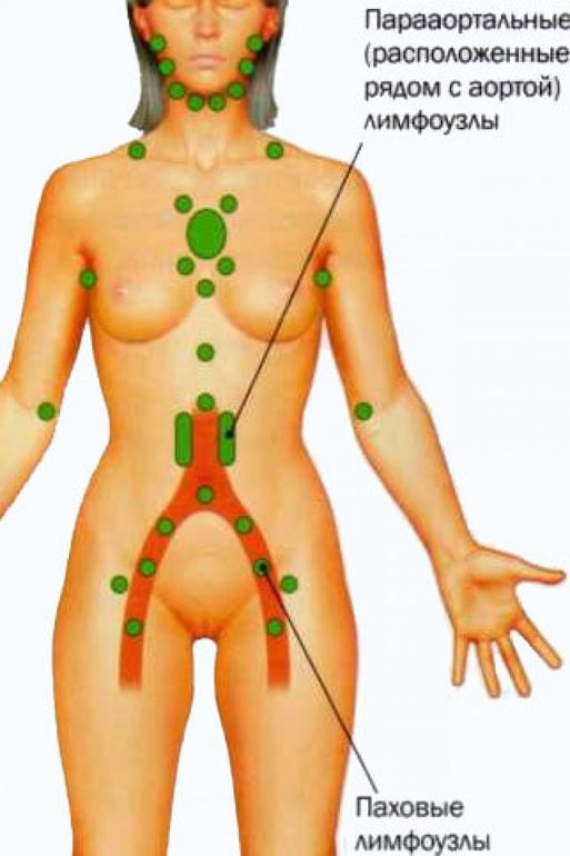 Где в паху у женщин находятся лимфоузлы фото у женщин