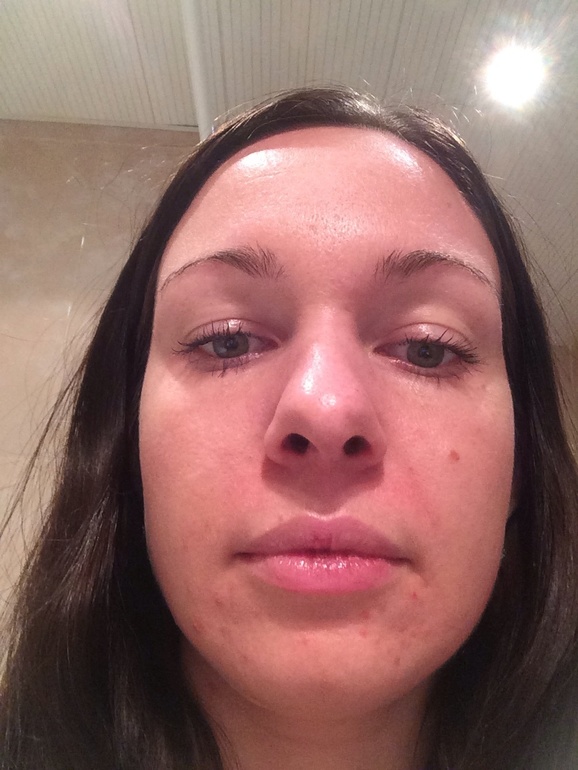 Начала уход!