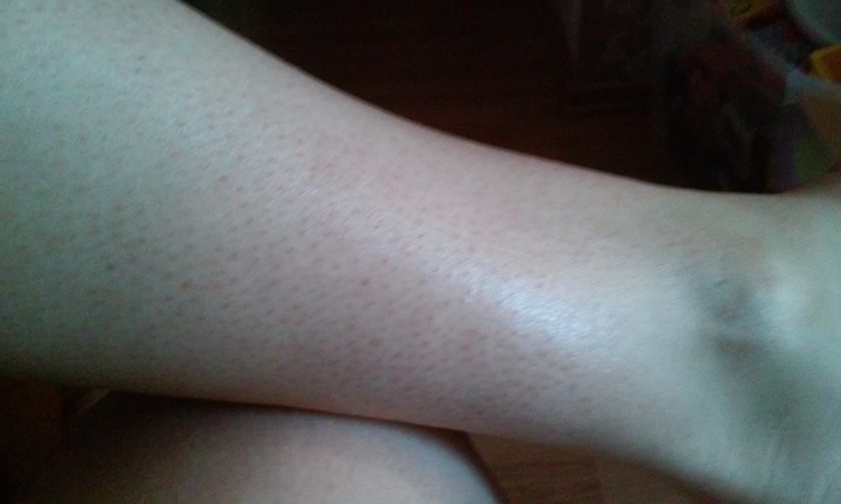 Как помочь коже стать как и раньше?ФОТО