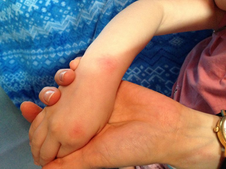 Что за пятна??