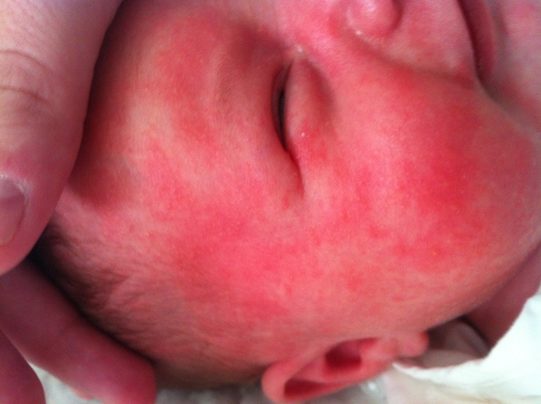 Питание кормящей мамы